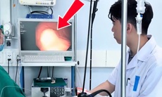 Đi khám vì ho, người đàn ông phát hiện u mô đệm dạ dày nguy hiểm