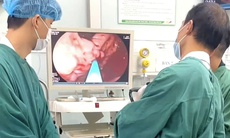 Nghĩ đau bụng bình thường, người đàn ông vào viện đã vỡ tĩnh mạch, máu phun thành tia trong dạ dày