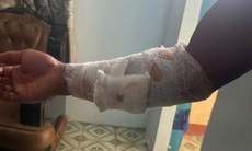 Truy tìm con cá sấu cắn nam thanh niên ở Khánh Hòa