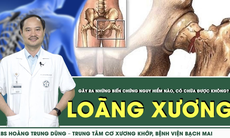 Loãng xương: Những biến chứng nguy hiểm và cách phòng ngừa