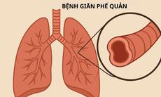 Ho ra máu cần cảnh giác với giãn phế quản
