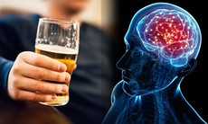 Uống mấy ly rượu mỗi ngày có thể tăng nguy cơ đột quỵ nghiêm trọng?