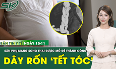 Bản Tin Y Tế 15/11: Mổ lấy thai thành công cho sản phụ mang song thai với dây rốn xoắn chặt