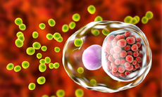 Bệnh Chlamydia có thể gây vô sinh