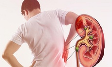 Người bệnh thận mạn tính cần thận trọng với những loại thuốc nào?