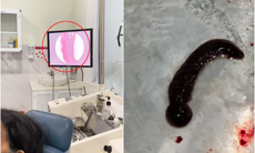 Hãi hùng con đỉa 6cm sống trong mũi cụ bà suốt 3 tuần