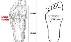 Bác sĩ y học cổ truyền khuyến cáo một số biện pháp phòng ngừa đột quỵ vào mùa lạnh