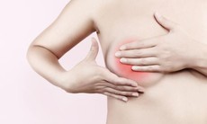 Cách kiểm tra phát hiện ung thư vú giai đoạn sớm