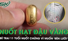 Bé trai 11 tuổi cấp cứu sau khi nuốt hạt đậu vàng 10 gram để ‘rèn lưỡi’ 
