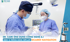 Trồng răng số 5 giá bao nhiêu - lựa chọn trồng răng Implant sao cho đúng?