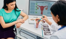 4 phương pháp phòng ngừa ung thư cổ tử cung hiệu quả