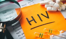 Chuyên gia chỉ cách phòng các bệnh không lây nhiễm đối với người có HIV