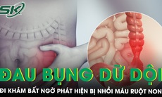 Chủ quan với dấu hiệu đau bụng, người đàn ông phát hiện bị nhồi máu ruột non 