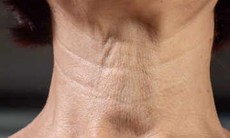 4 bài tập đơn giản xóa nếp nhăn, làm săn chắc vùng cổ tự nhiên tại nhà