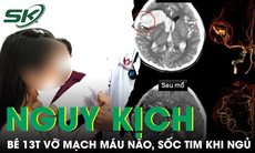 Bé gái 13 tuổi ở TP.HCM vỡ mạch máu não, sốc tim nguy kịch khi đang ngủ