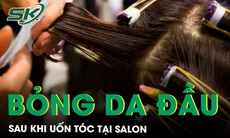 Nữ khách hàng bỏng da đầu sau khi uốn tóc tại salon