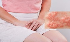 Nhiều trẻ vị thành niên mắc bệnh tình dục do quan hệ sớm