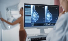 Tầm soát ung thư: Khi nào là cần, khi nào là lạm dụng?