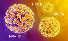 Chủng virus HPV nào dễ gây ung thư cổ tử cung nhất?