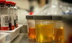 Tiểu ra máu có nguy hiểm không?