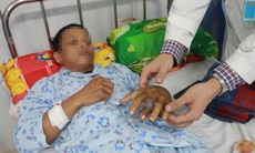 Bệnh viện tuyến tỉnh cứu sống nam thanh niên bị rắn cực độc cắn nguy kịch