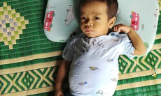 Xót xa hoàn cảnh bé trai bị teo mật bẩm sinh, mẹ sẵn sàng hiến gan cứu con nhưng không đủ kinh phí điều trị