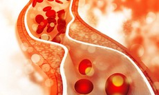 Tăng triglycerid máu: Hiểm họa tiềm ẩn và cách kiểm soát hiệu quả