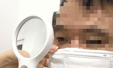 Người đàn ông bị rận mu hành hạ suốt một năm