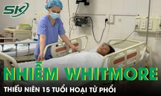 Thiếu niên 15 tuổi nguy kịch vì nhiễm Whitmore gây hoại tử phổi