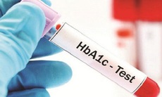 Ý nghĩa của xét nghiệm HbA1c trong bệnh đái tháo đường