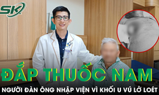 Tự chữa bằng thuốc nam, người đàn ông nhập viện vì khối u vú lở loét