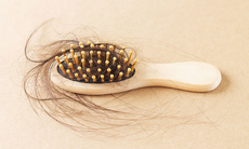 Tạm biệt rụng tóc hiệu quả với 3 bài thuốc dân gian rẻ tiền, dễ kiếm