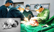 Bất ngờ phát hiện u buồng trứng gần 3kg sau chấn thương sọ não