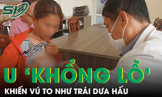 Cắt khối u vú to như trái dưa hấu cho bệnh nhân Campuchia