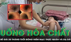 Uống nhầm hóa chất, bé gái 20 tháng tuổi suy hô hấp, hoại tử niêm mạc