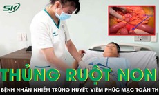 Phẫu thuật cho bệnh nhân bị nhiễm trùng huyết nặng, viêm phúc mạc toàn thể do thủng ruột non
