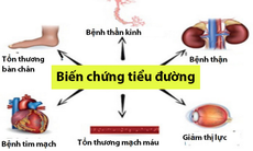 Các biến chứng cơ xương khớp thường gặp khi mắc đái tháo đường