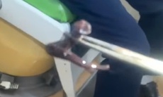 Người đàn ông bất ngờ bị đỉa rừng dài 7cm chui vào hốc mũi