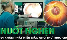 Khó nuốt kéo dài sau tết, người đàn ông phát hiện ung thư thực quản