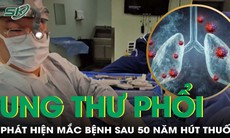 Phát hiện mắc ung thư phổi sau 50 năm hút thuốc lào