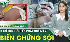 Bản tin Y tế ngày 18/2: Ba bệnh nhi suy hô hấp do biến chứng sởi