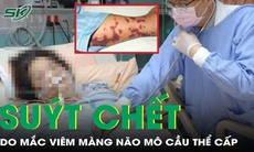 Người phụ nữ thoát chết trong gang tấc vì viêm màng não mô cầu thể cấp
