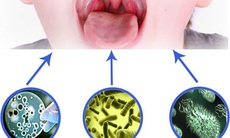 Cách chăm sóc  trẻ bị viêm mũi họng cấp khi giao mùa