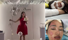 Cô gái Hà Nội kể lại khoảnh khắc kinh hoàng bóng bay phát nổ trong ngày sinh nhật