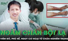 Phù nề, nguy cơ hoại tử hai bàn chân do ngâm chân bằng bột không rõ nguồn gốc