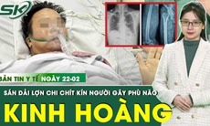 Bản tin Y tế 22/2: Phù não, co giật vì sán dải lợn ký sinh khắp cơ thể