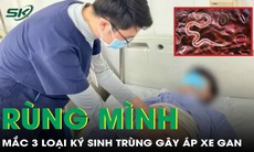 Nam thanh niên mắc 3 loại ký sinh trùng cùng lúc, tàn phá gan nặng nề