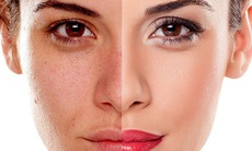 Cải thiện làn da xỉn màu cho chị em ngoài 30 tuổi