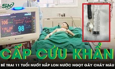 Bé trai 11 tuổi nhập viện khẩn cấp vì nuốt nắp lon nước ngọt gây chảy máu