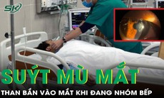 Bỏng giác mạc do than nóng bắn vào mắt khi đang nhóm bếp nướng